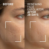 Result of using Dr Brandt Microdermabrasion Body Exfoliator - reduced texture and fine lines on face and body
