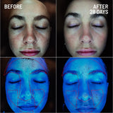 Before and after comparison of skin treated with Dr Brandt Microdermabrasion Body Exfoliator - clearer and smoother skin