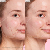 Glow Recipe Blackberry Retinol Blemish Serum 30ml - Brands Point AE