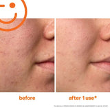 Kate Somerville ExfoliKate Intensive Exfoliating Treatment 60ml tube side view