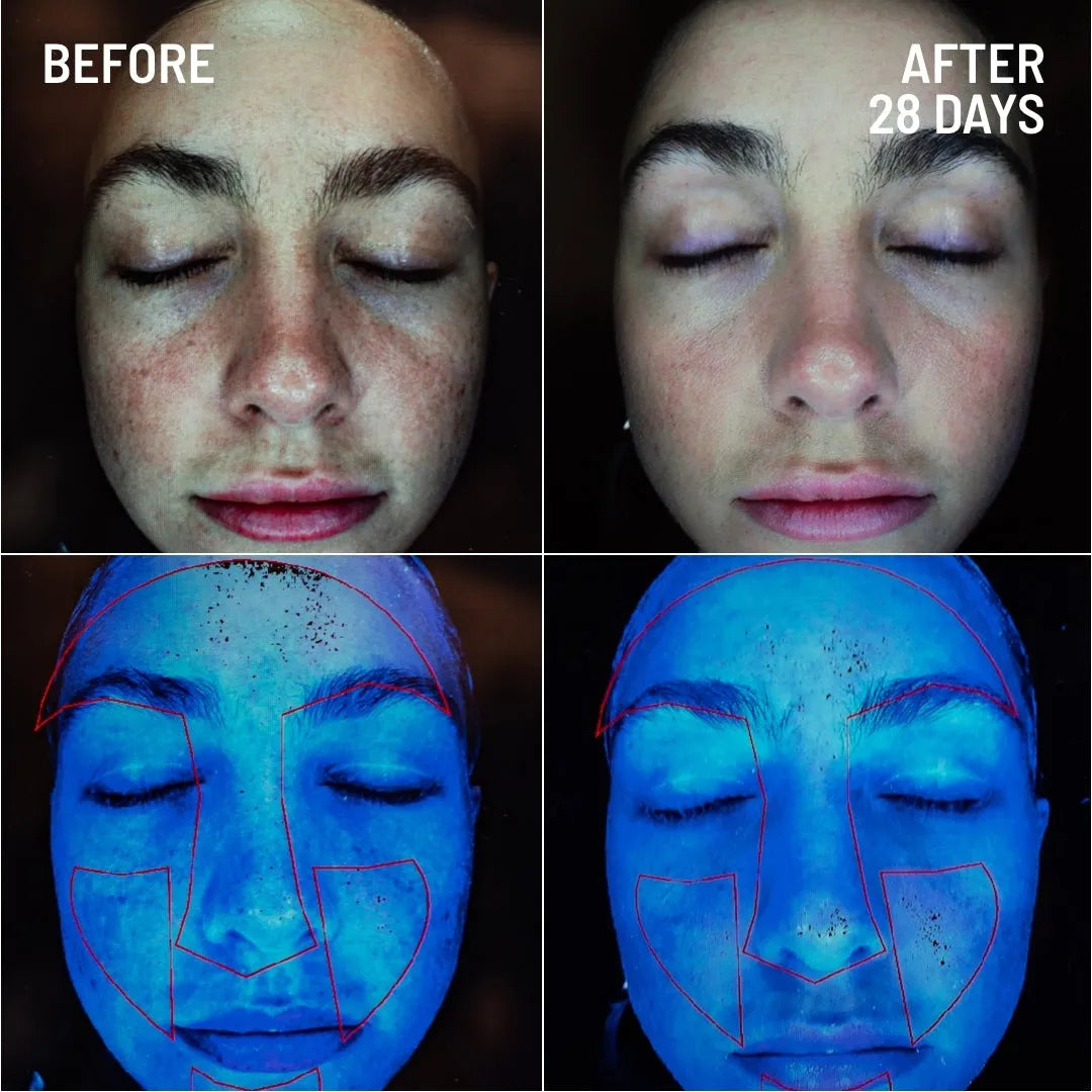 Before and after comparison of skin treated with Dr Brandt Microdermabrasion Body Exfoliator - clearer and smoother skin