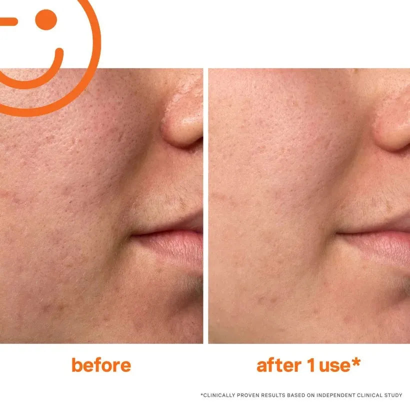 Kate Somerville ExfoliKate Intensive Exfoliating Treatment 60ml tube side view