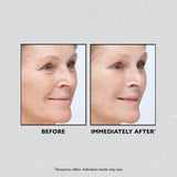 Before and after application of Peter Thomas Roth Instant Firmx, showing tightened and smoother skin on a woman's face